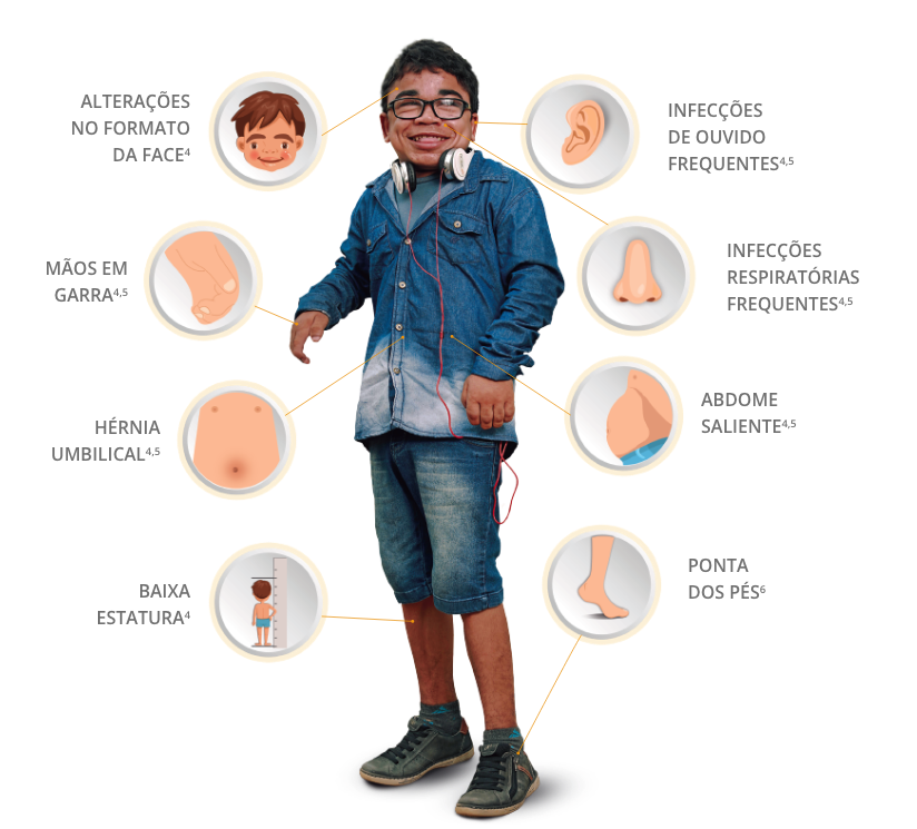 Sinais e Sintomas da mucopolissacaridose tipo II (MPS II)